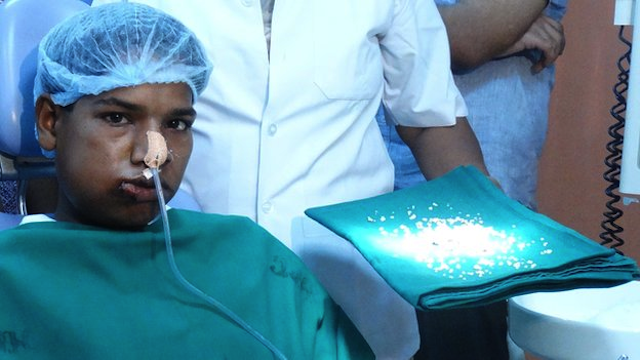 Boy With 232 Teeth