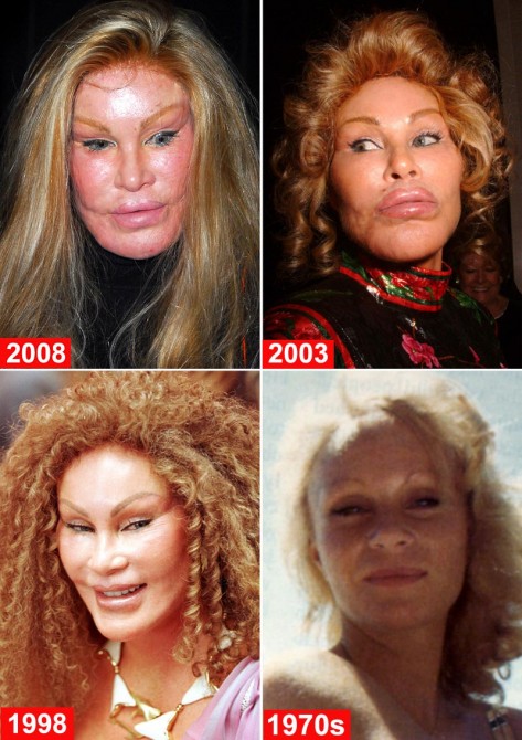 Jocelyn Wildenstein - before after during