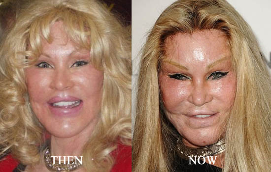 Jocelyn Wildenstein - before after