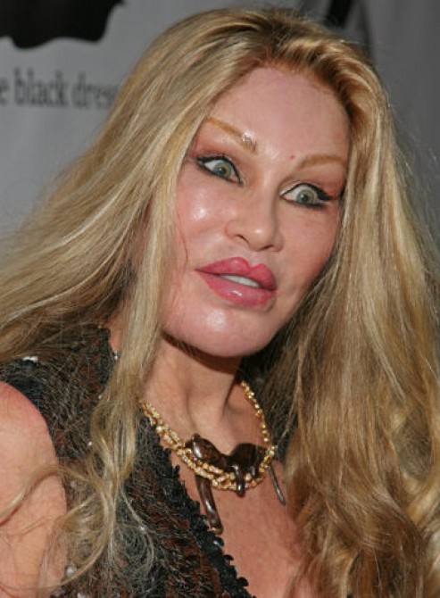 Jocelyn Wildenstein - weird face