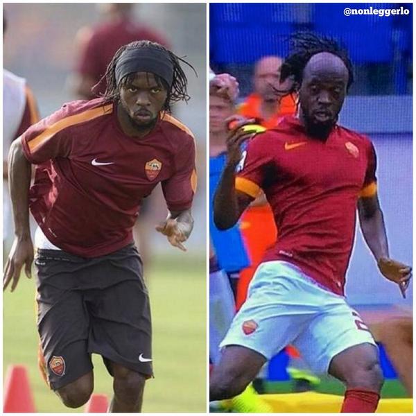 Gervinho Hairline