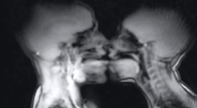 Sex MRI Scan