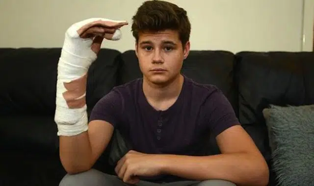 Teen Trying To Impress His Girlfriend With A Firework Almost Blows His Entire Hand Off (NSFW)