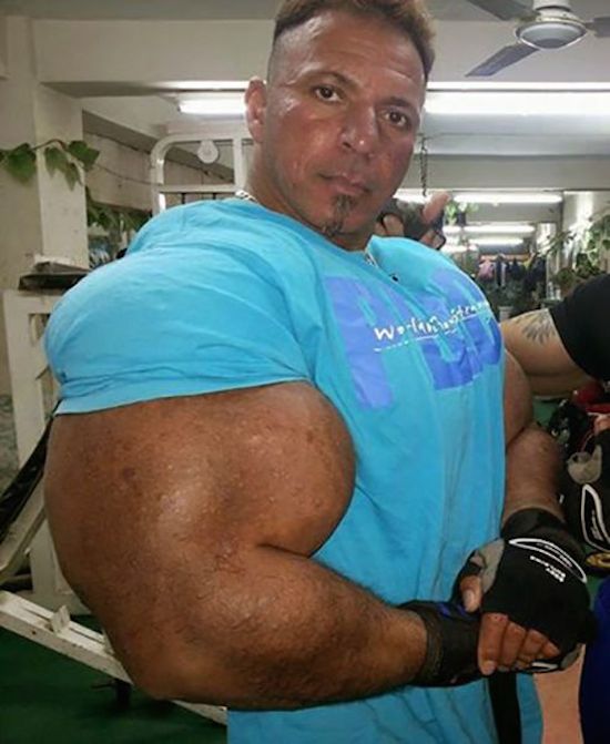 synthol and steroid bodybuilder 20