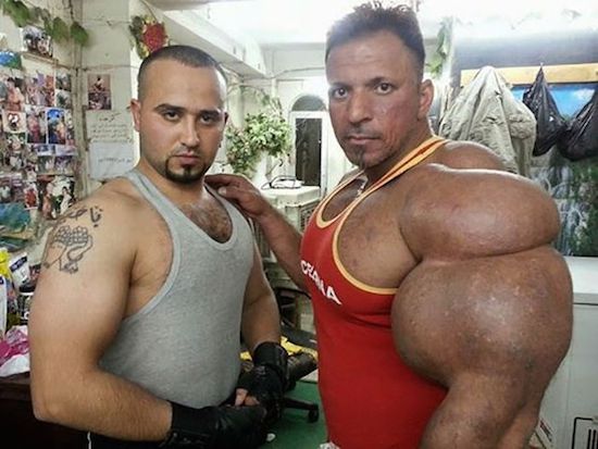 synthol and steroid bodybuilder 3