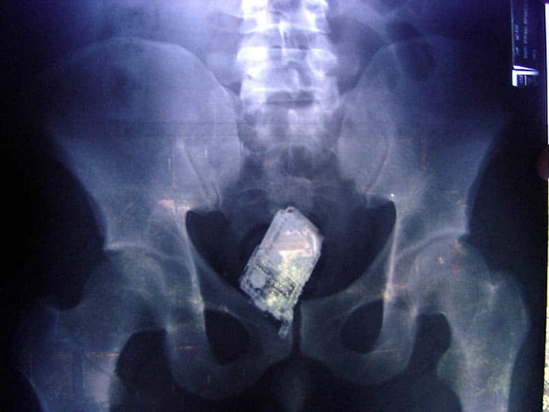 Bizarre X Rays 12