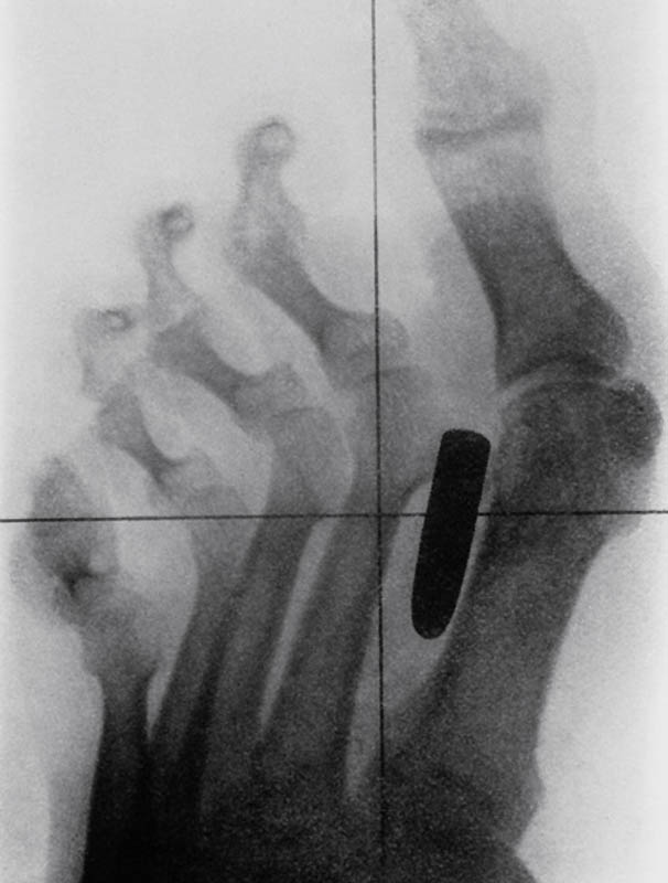 Bizarre X Rays 17