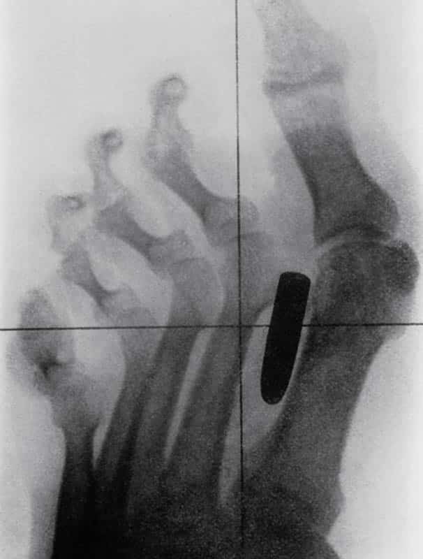 Bizarre X Rays 17