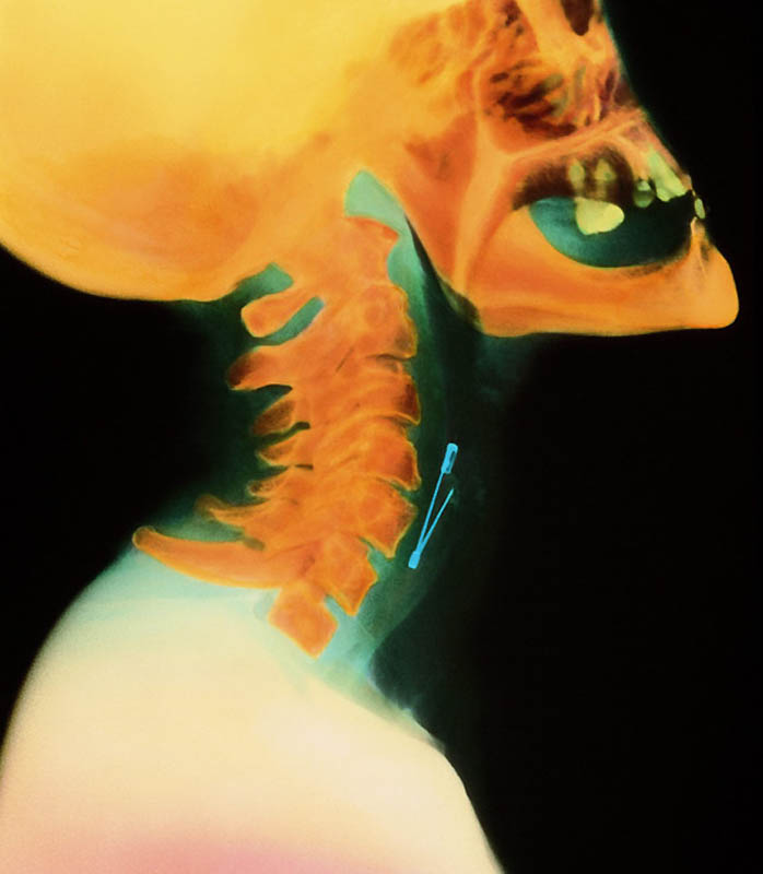 Bizarre X Rays 4