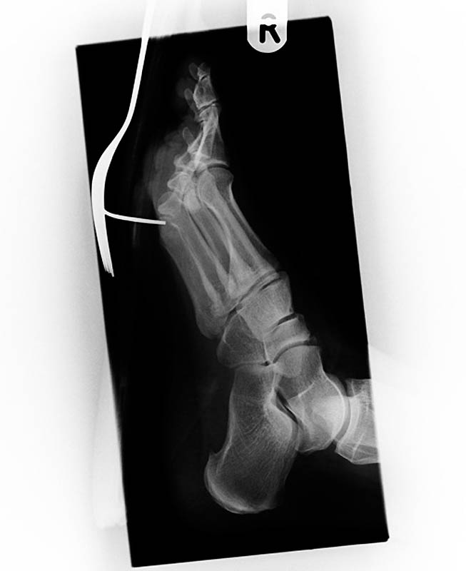 Bizarre X Rays 5