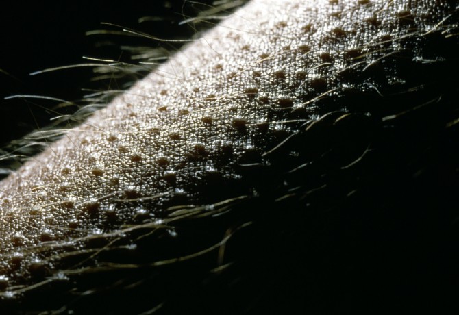 Macrophoto of goose-flesh on skin of man's arm
