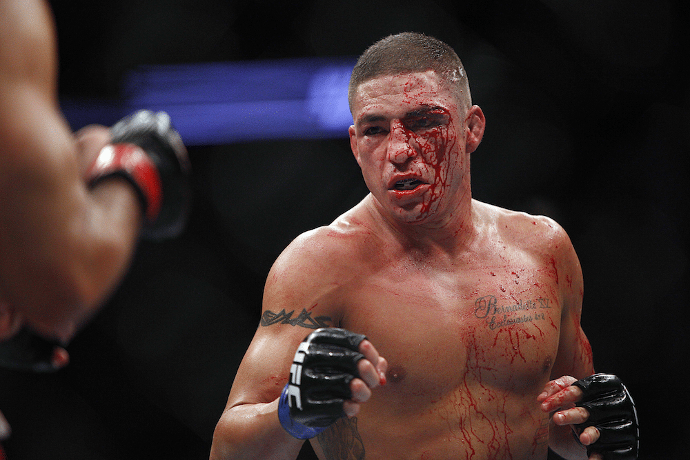 Worst MMA Injuries