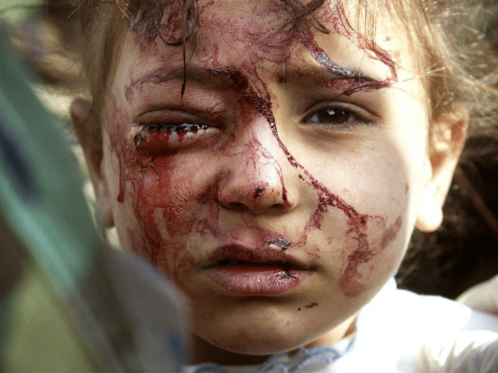 Irag Decade - Wounded Girl