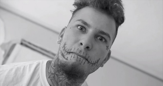 Stitches - Close Up