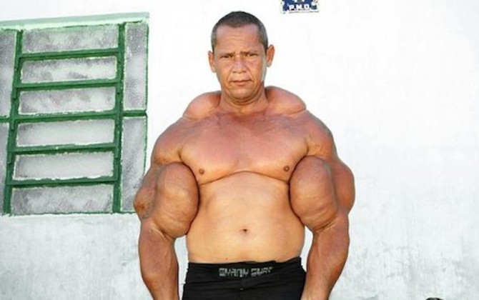 Weak Synthol Freak