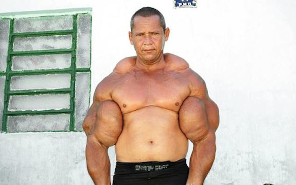 Image result for synthol arms