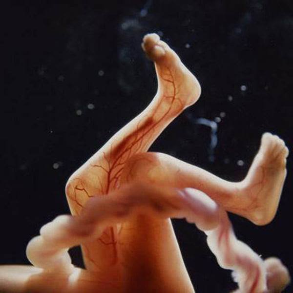 Pregnancy Photographs In The Womb 18
