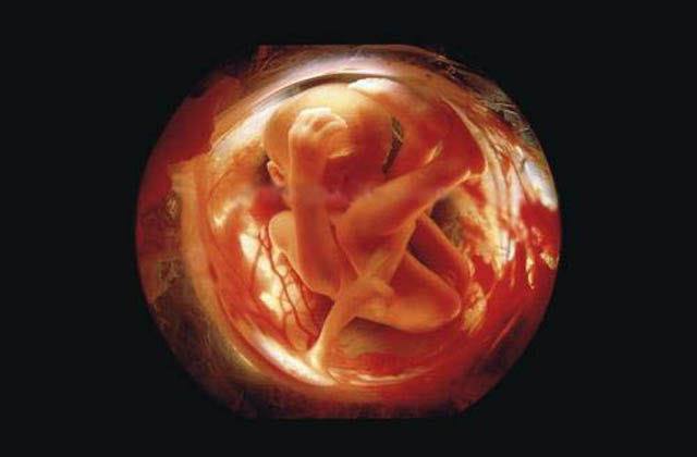Pregnancy Photographs In The Womb 23