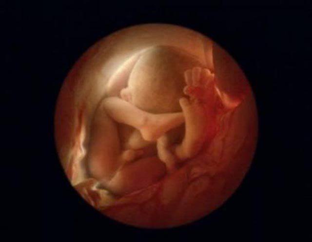 Pregnancy Photographs In The Womb 25