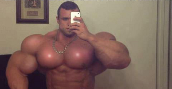 Synthol 1