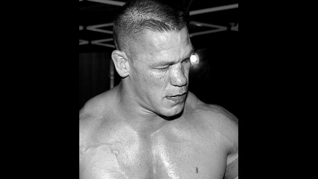 John Cena Broken Nose 1