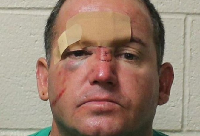 Softball Dad Beaten Up