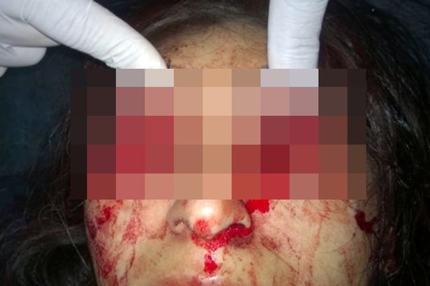gouged raped exorcism gouging horrific ordered cungkil rogol arah demoni sorellina liberarti possessed superstarz terrified mangsa remaja