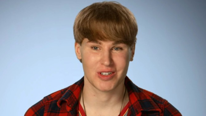 Justin Bieber $100K Plastic Srugery Lookalike