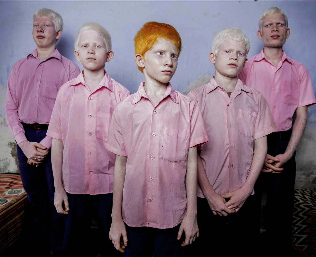 Brent Stirton - Albino Family