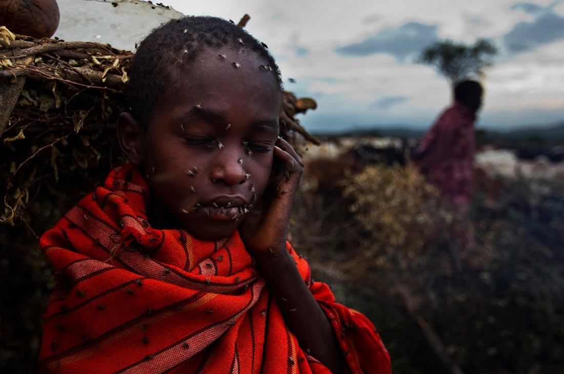 Brent Stirton - Boy With Flies