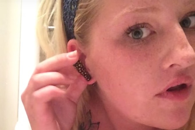 Girl Stretching Earlobe Rips Ear Off