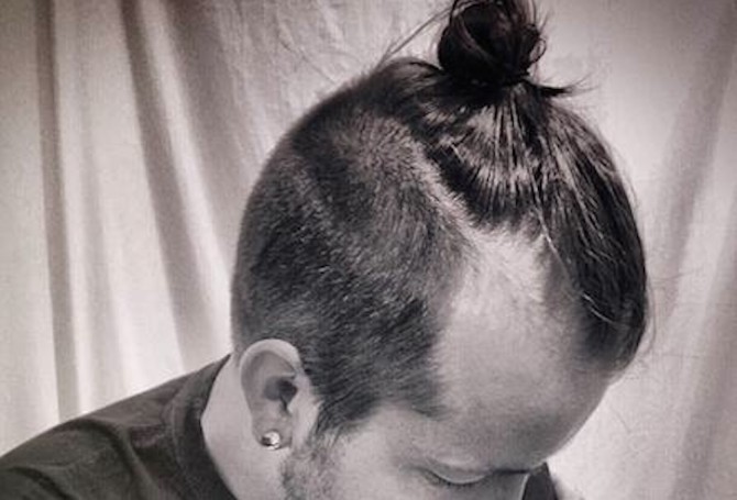 Man Bun Baldness