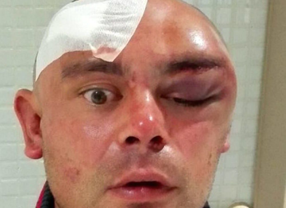 Ibiza DJ Cannibal Attack
