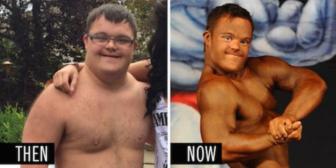Down's Syndrome Body Builder