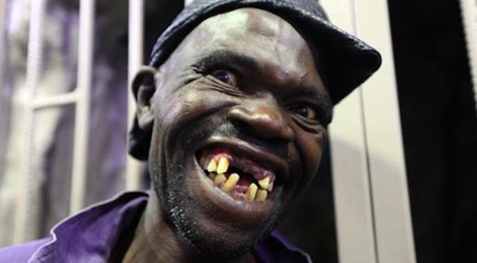 Mister Ugly Competition Winner