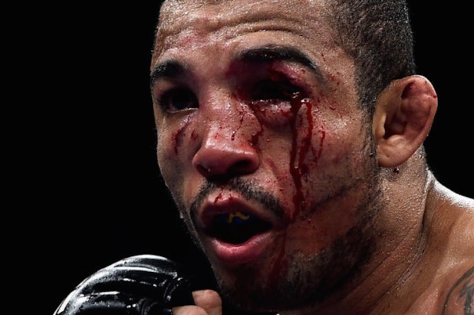 Jose Aldo