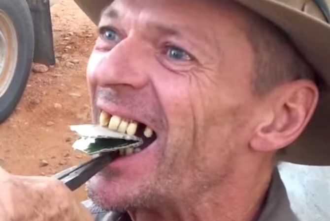 Australian Guy Teeth