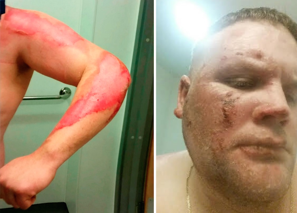 Kevin Woodward Injuries