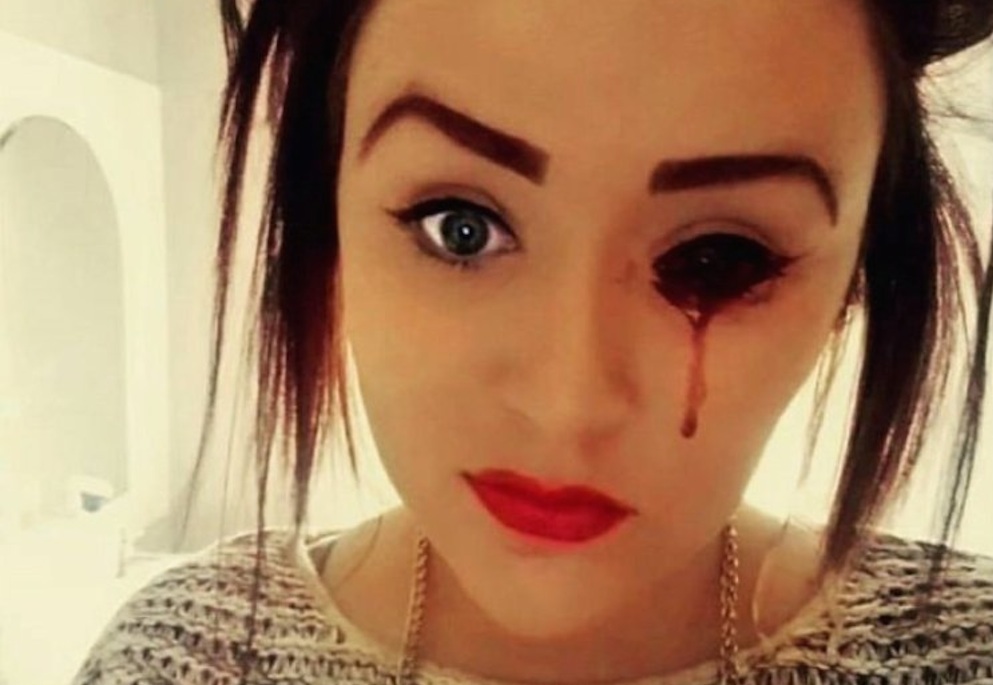 Blood Seeping Girls Eye Featured