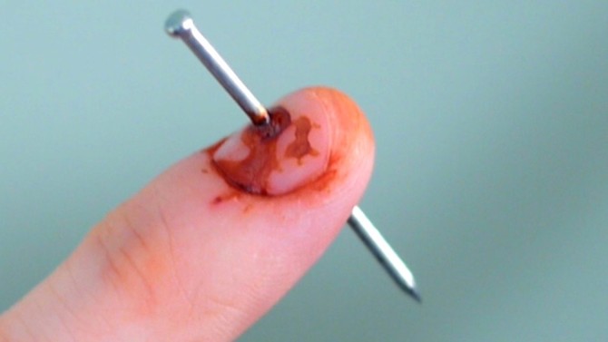 Nail In Finger