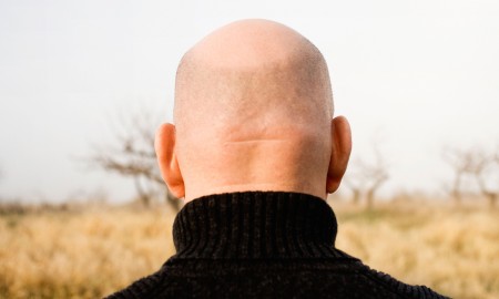 Bald