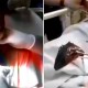 Fish Removed Throat