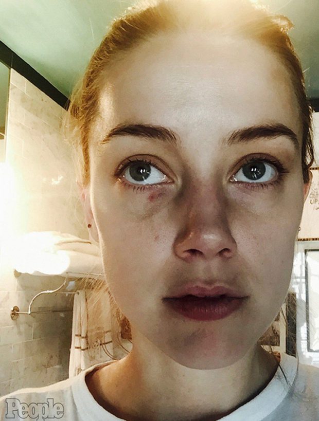 Amber Heard Domestic Abuse 3