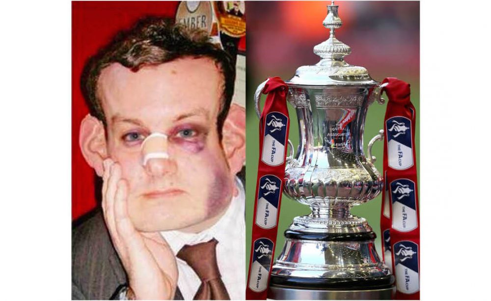 Man FA cup head