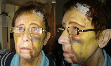 OAP Brick Smashed In Face