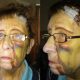 OAP Brick Smashed In Face