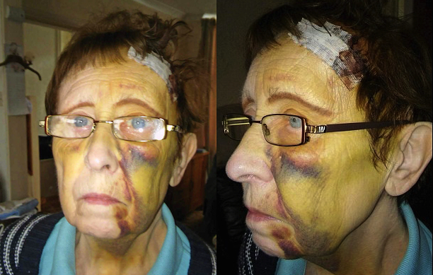 OAP Brick Smashed In Face