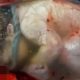 Baby Inside Amniotic Sack