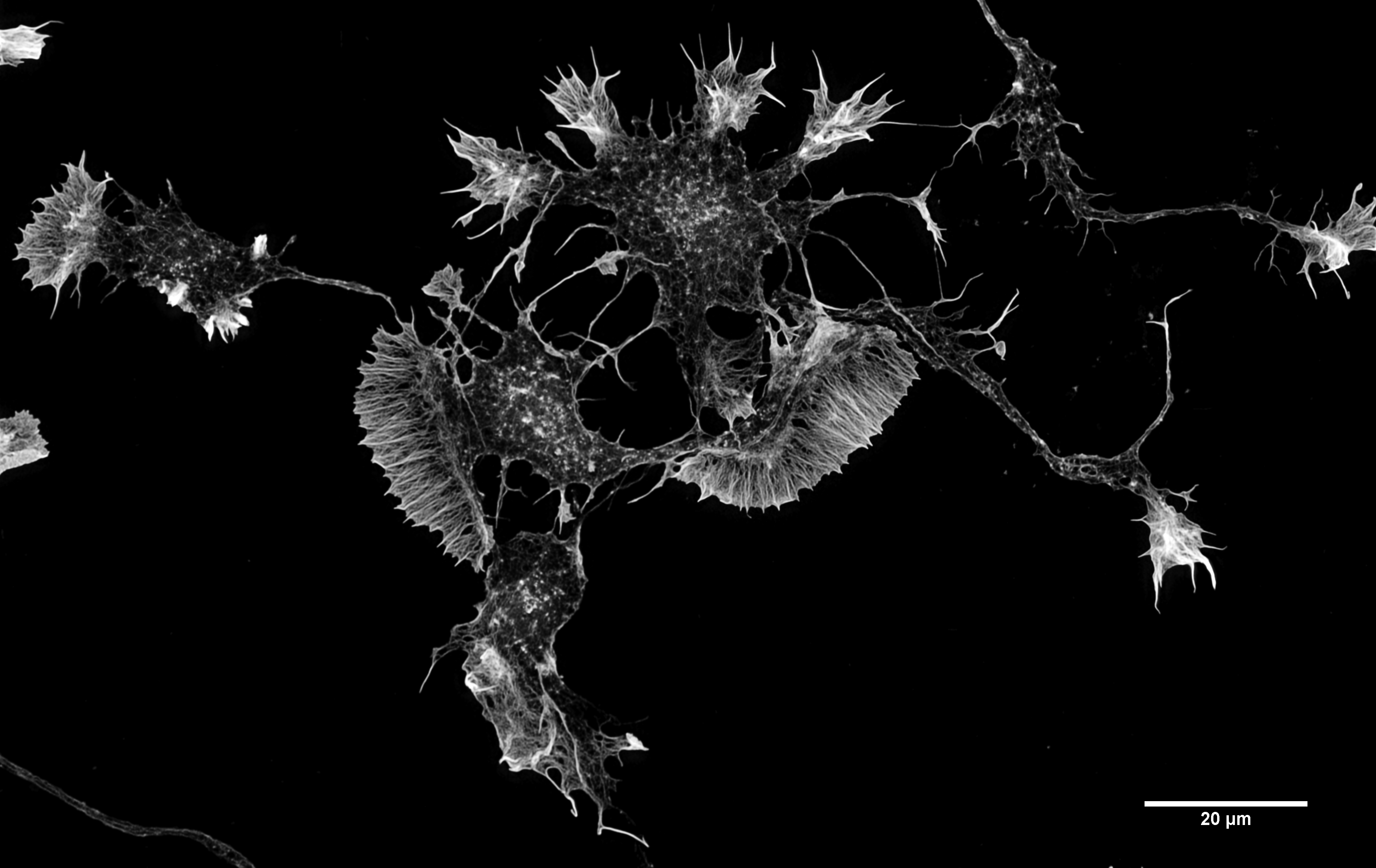 Consciousness Mouse Neuron