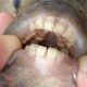 Fish Human Teeth